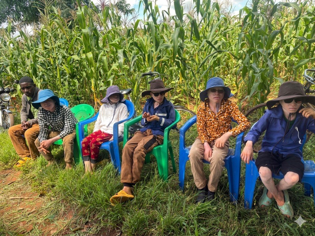 Albinism Advocacy